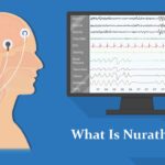 What Is Nurathopy & Everything You Need To Know About