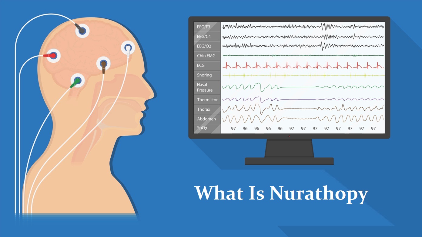 What Is Nurathopy & Everything You Need To Know About